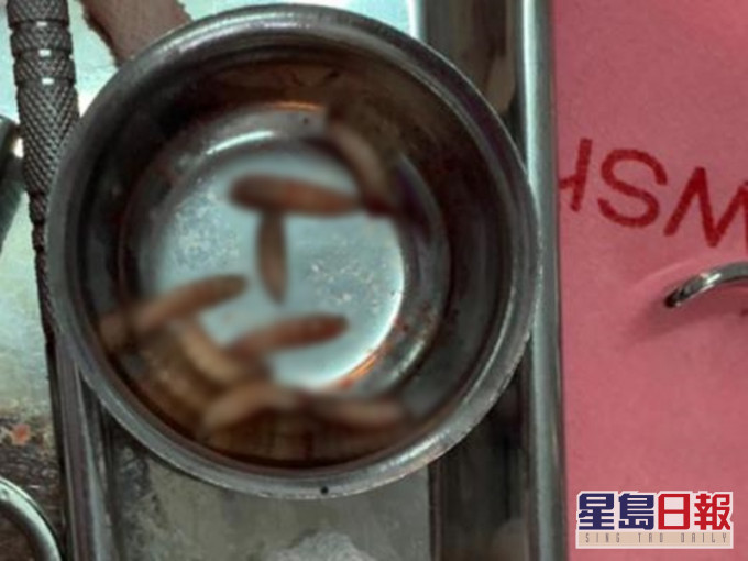 泰老翁高燒牙齦腫痛無法說話送院,驚揭12條蛆蟲牙齦築巢。Thanatnon Rong Assava Facebook