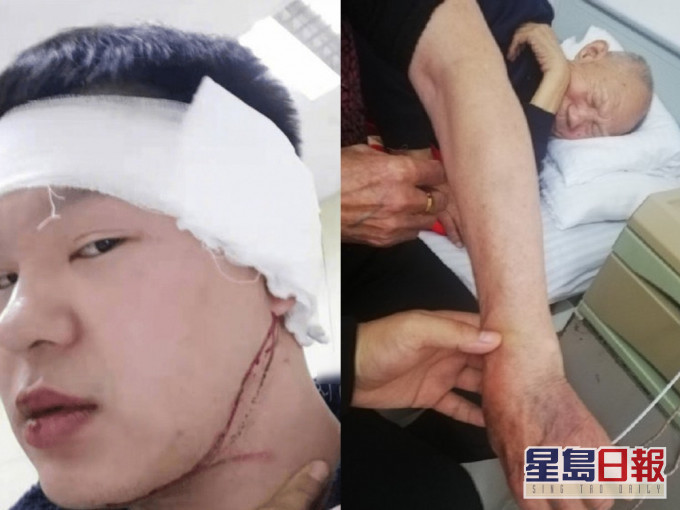 男子提醒邻居噪音全家遭暴打,反被以互殴行拘又被公司开除。