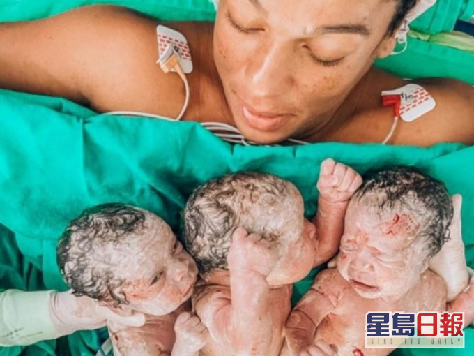 巴西母剖腹诞三胞胎后严重出血致并发症，抢救3天后终证实不治。