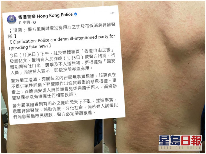 「香港自由之書」fb附上的背面相片。小圖為警方澄清。網上截圖