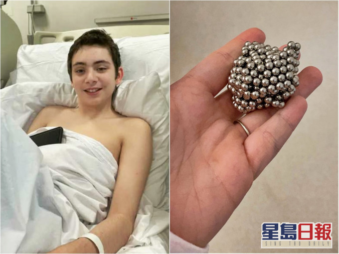 英國一名男孩為做實驗,竟吞下54粒小磁珠,差點送命。網圖