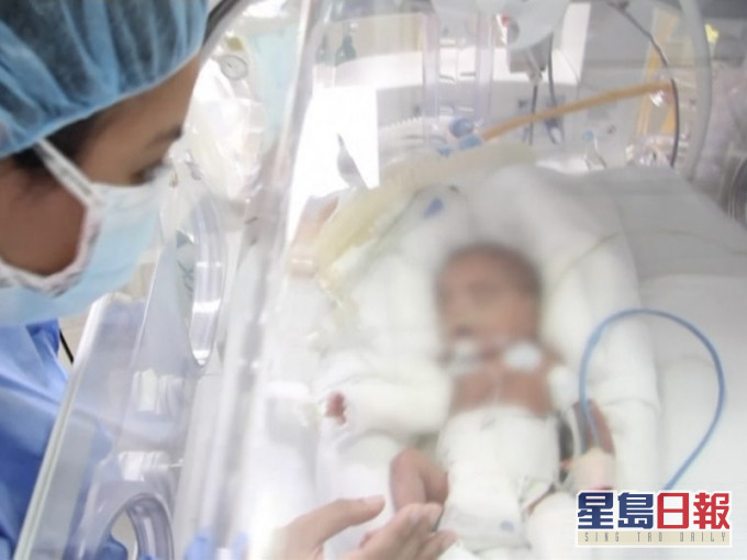 秘鲁一名23周只有580克早产婴儿成功克服新冠肺炎。(网图)