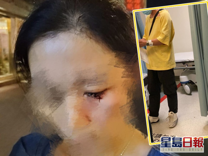 冰室老板夫妇遇袭受伤。区议员张秀贤fb图片