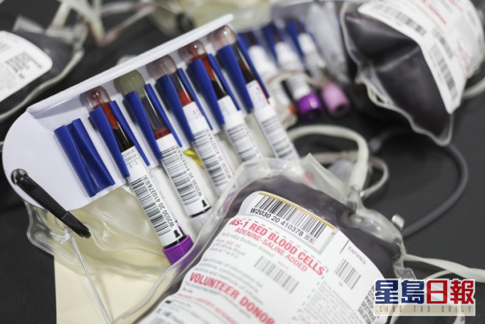 意大利北部小镇有60名捐血者中有40人确诊 ,均为无症状患者。(示意图,AP)