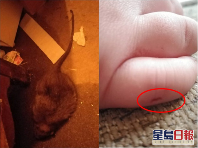 英国一名岁半男婴遭老鼠咬伤。网图