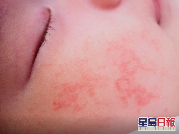 22款嬰幼兒潤膚乳含香料致敏物。消委會圖片