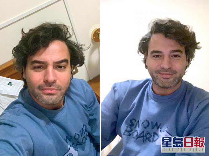 33歲羅馬律師Andrea Napoli憶述感染歷程,以及醫院慘況。AP
