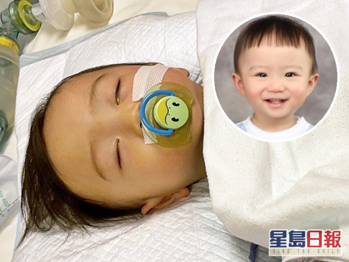 1岁男童区柏熙急需肝脏移植保命。