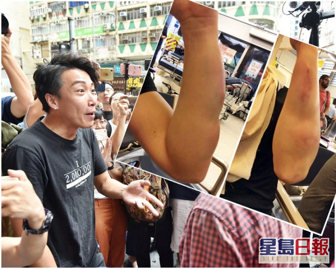 岑子杰去年8月底与友人在餐厅用膳时遭人伏击。资料图片