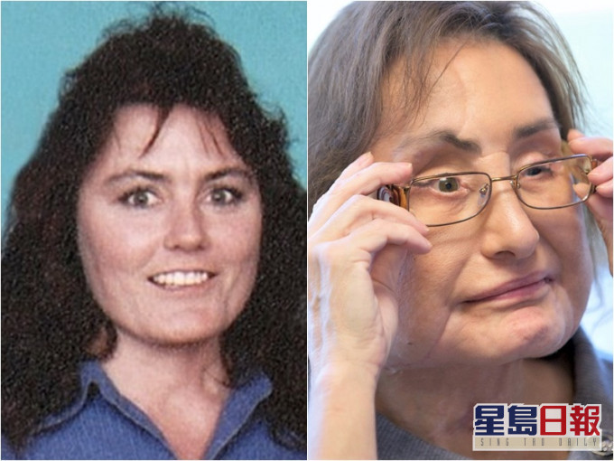 卡尔普换面前(左图)及换面后的样子(右图)。
