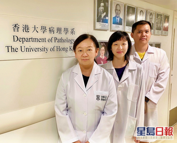 港大病理学系副教授任蕙苹(左)及其研究团队。