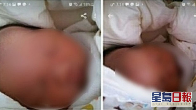 20歲單親南韓媽媽生產後數天,在拍賣網出售親生女兒,稱沒有金錢撫養孩子。(網圖)