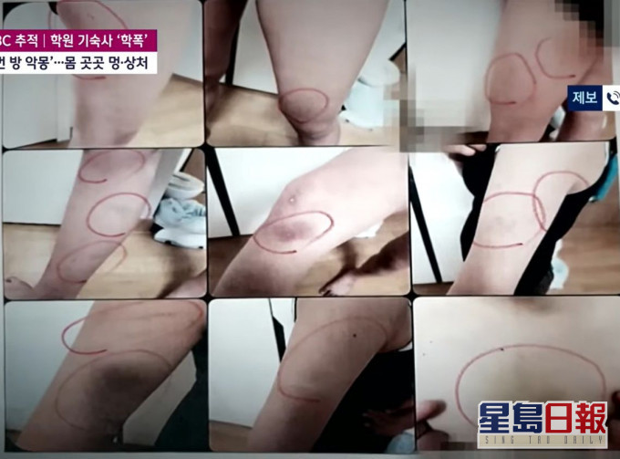 受害女学生身上有多处伤痕。JTBC影片截图