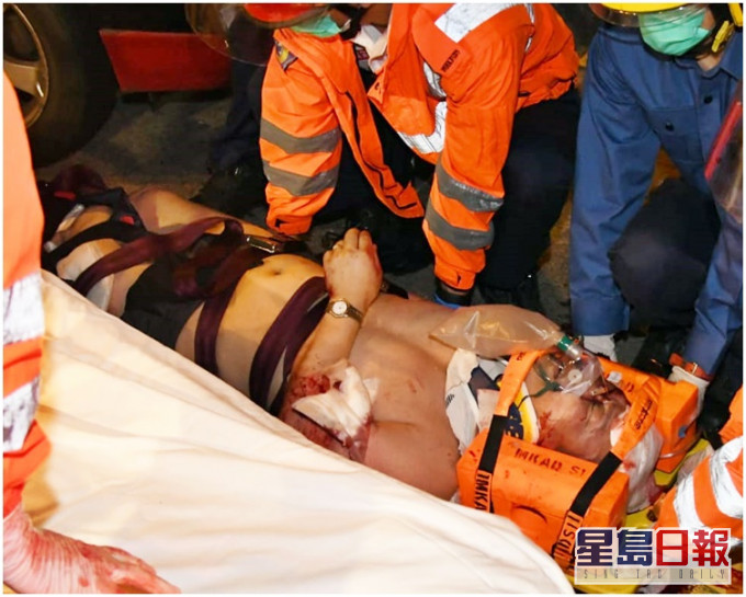 事主受傷，清醒被送往伊利沙伯醫院搶救。