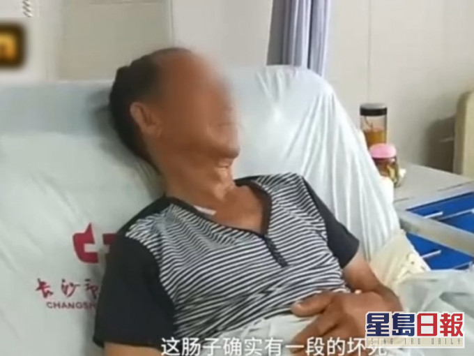 湖南老翁被確診患上「急性出血壞死性小腸炎」。網圖