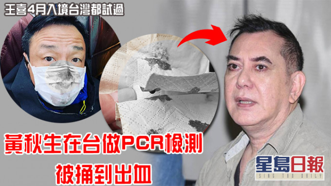 繼王喜後，再有港星在台灣做PCR檢測遇到出血情況。