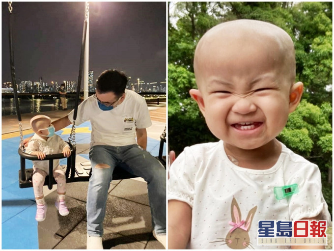 19個月大的女嬰梓瑤,於去年10月因發燒入院,其後證實她患上罕見的第4期神經母細胞瘤。「We are family 梓瑤」FB圖片