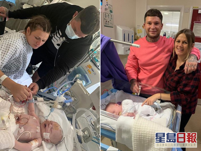 Alessi出生後卻出現併發症,大腦嚴重受損導致沒有心跳、沒有哭泣。