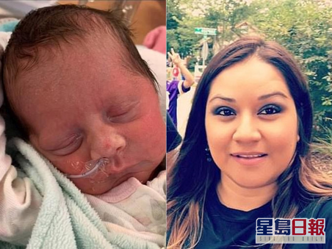 美國35歲確診孕婦Aurora（右）戴呼吸機緊急剖腹誕女，與病魔搏鬥一個月離世。（FB圖）