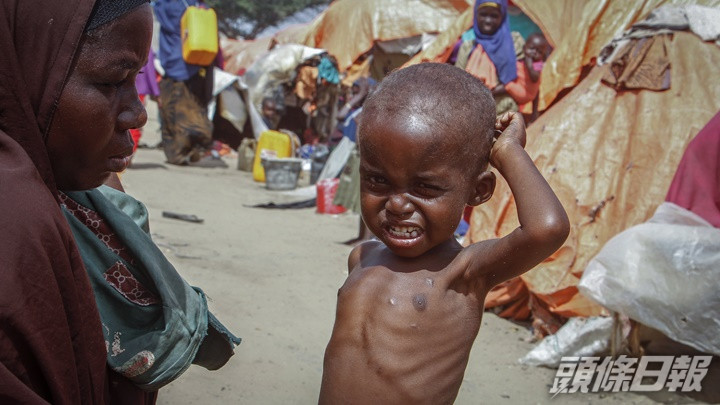 聯合國兒童基金會指逾700童在索馬里營養中心死亡。AP資料圖片