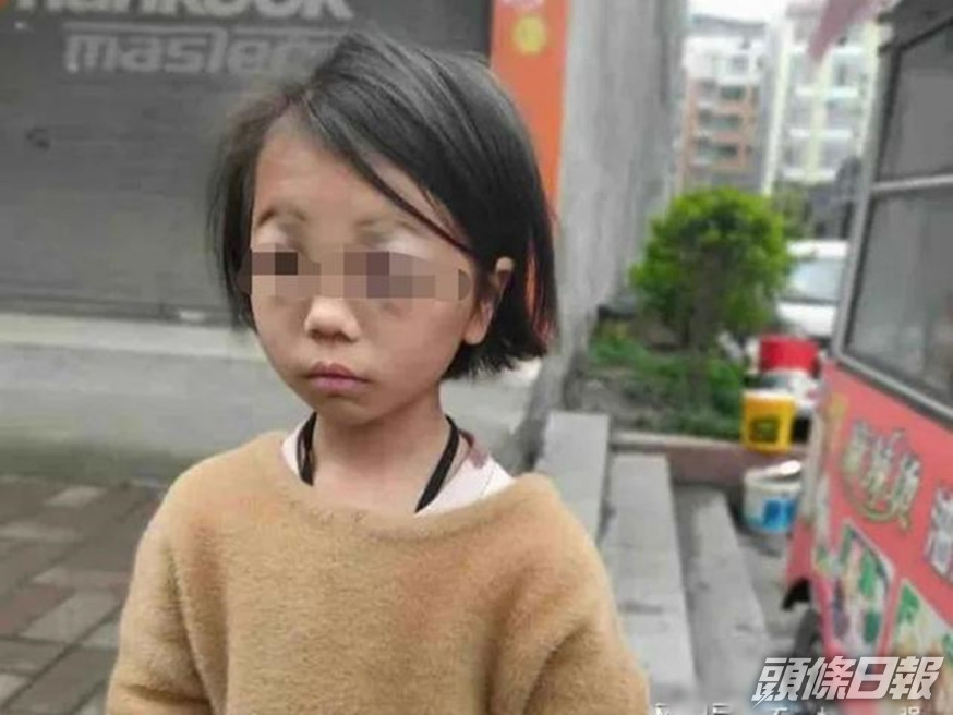小麗年僅8歲。網圖