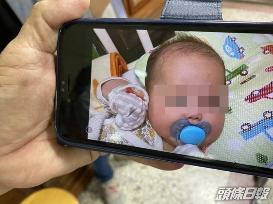 台灣當局解剖檢驗指,母親打針後餵母乳猝死的女嬰,有呼吸道感染。網圖