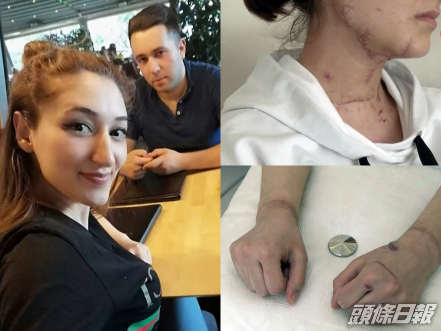 土耳其男子以送「驚喜」為借口,將女友綁手腳用刀狂刺兼開車輾過。