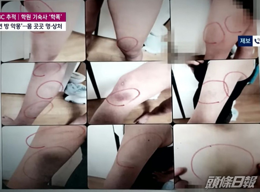 受害女學生身上有多處傷痕。JTBC影片截圖