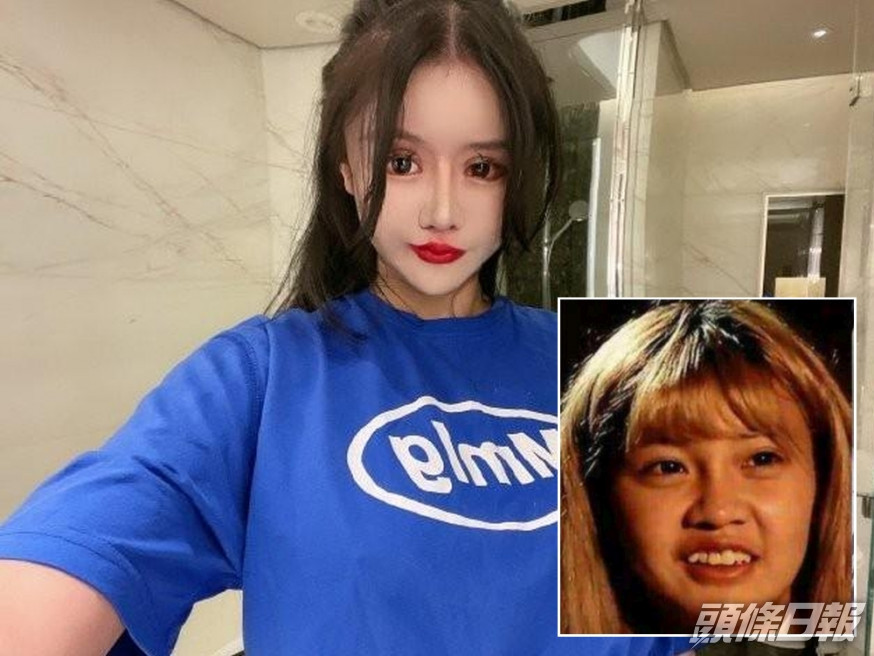13歲起整容近百次致記憶衰退,上海網紅周楚娜仍繼續不斷整容。