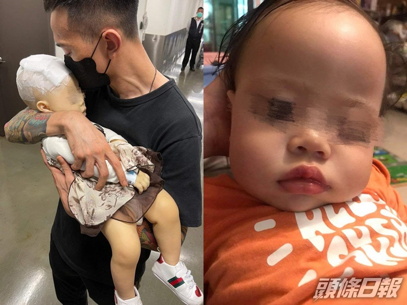 女嬰送到保母家後,因腦出血、雙眼滲血送醫。fb