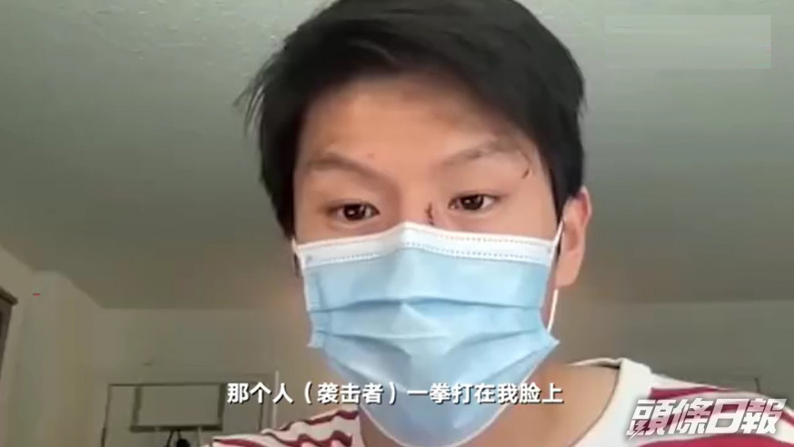 中國留學生在加拿大被持刀男子襲擊。網上圖片