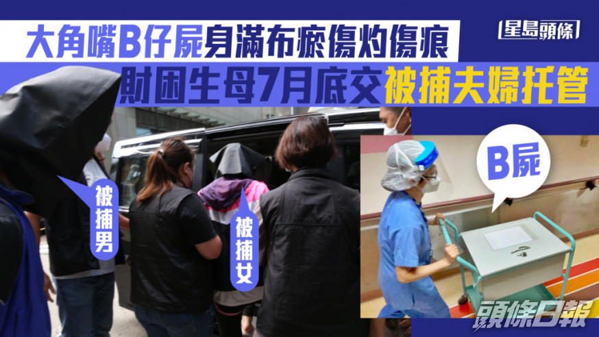 男嬰屍身有多處瘀傷及灼傷。