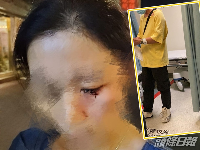 冰室老闆夫婦遇襲受傷。區議員張秀賢fb圖片