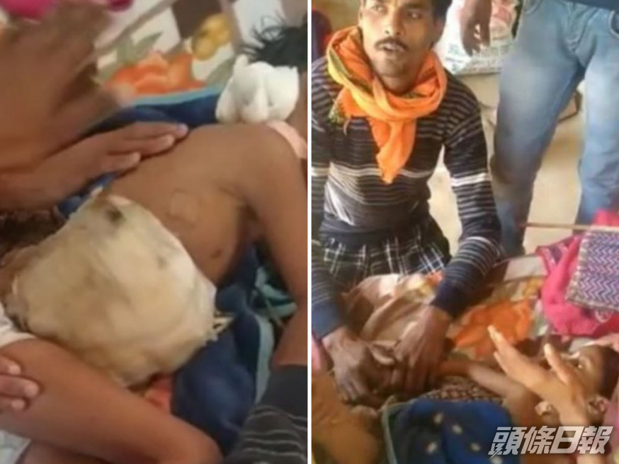 無良醫生收唔夠錢拒縫手術傷口,3歲女童慘死醫院大門前。(網圖)