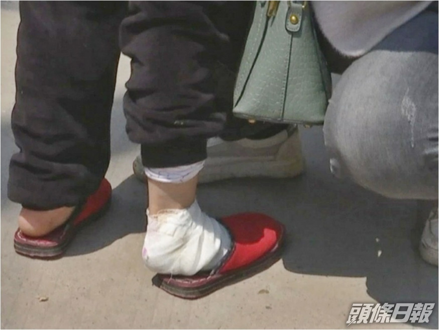 學生遭老師用熱水潑腳。網圖