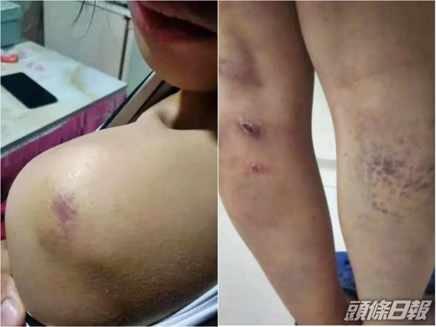 貴州一間中學有老師對學生進行體罰。網圖
