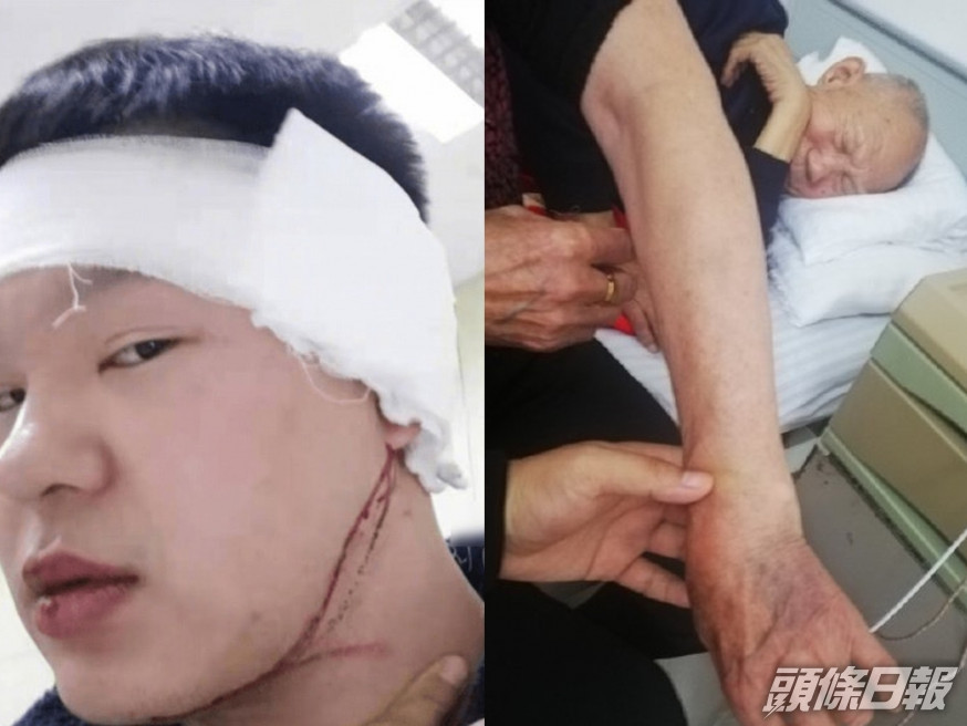 男子提醒鄰居噪音全家遭暴打,反被以互毆行拘又被公司開除。