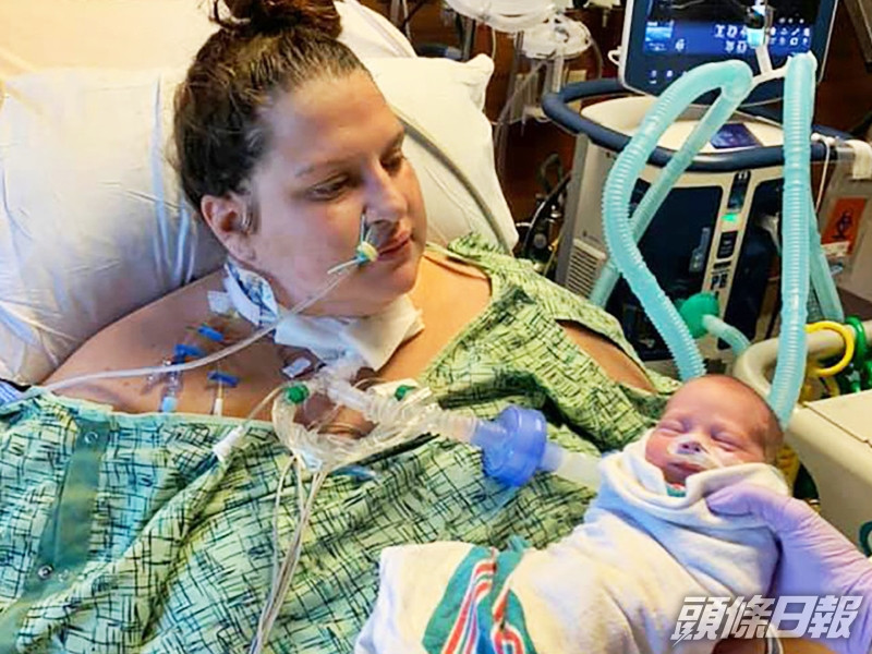 美國一名30歲確診孕婦早前病危住院,一度陷入昏迷20天,怎料再次醒來時發現孩子已出生。網圖