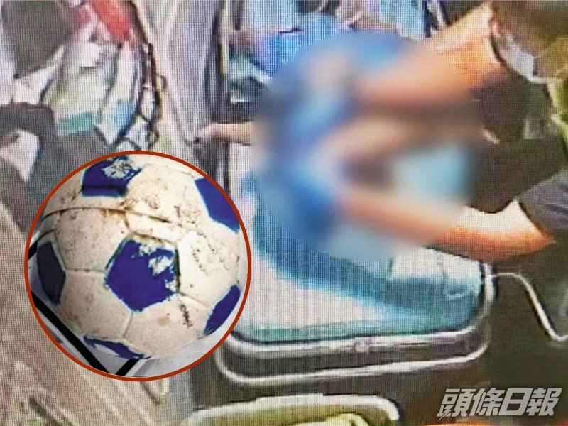 男童堅持21天後因缺氧性腦病變,恐無法復原,家屬只好決定忍痛拔喉。網圖
