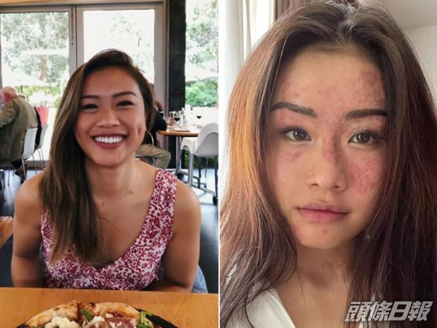莎琳分享整個復原過程。IG圖片