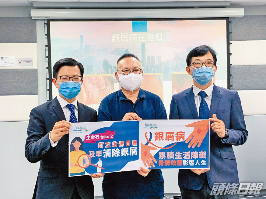 生物製劑治銀屑病 逾六成病人全面改善