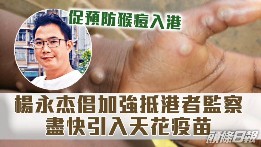 楊永杰促請政府超前部署，預防猴痘入侵香港。資料圖片