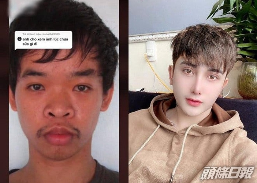 越南男子杜文奎整容前被嘲樣貌醜找不到工作(左),結果他整容九次變成另一個樣子(右)。網圖
