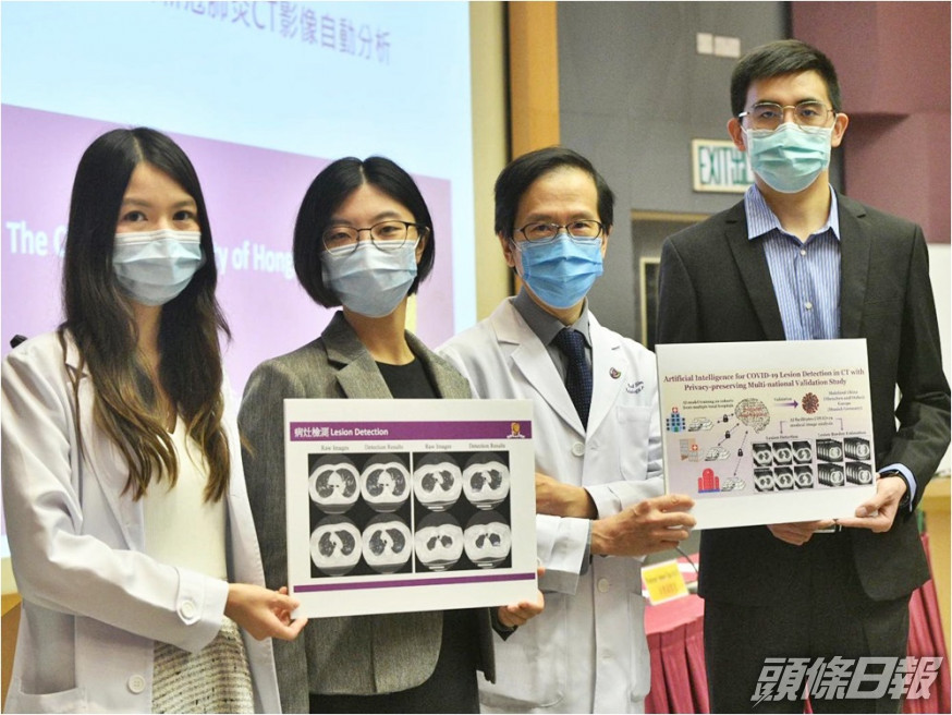 中大研究團隊開發新一代人工智能系統自動分析新冠肺炎CT影像。蘇正謙攝