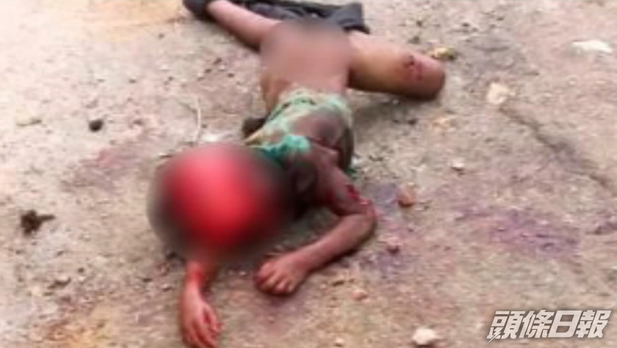牙買加5歲男童艾倫遭野狗襲擊致血肉模糊。網上圖片