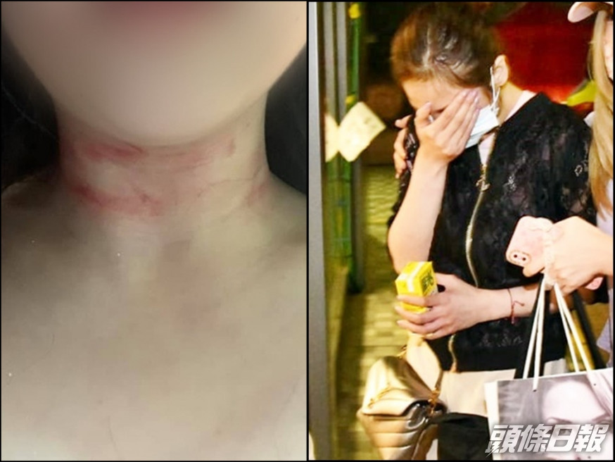 女事主被賊人暴力勒頸。Facebook圖片