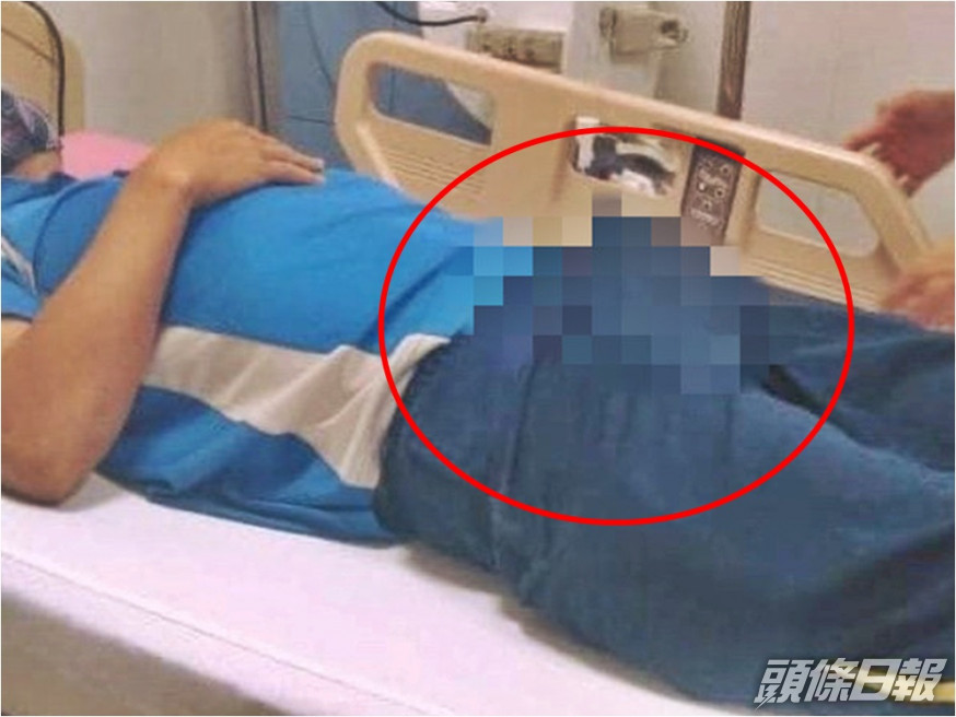 越南一名男子因喝下3枝壯陽藥,而導致出現終生性功能勃起障礙。網圖