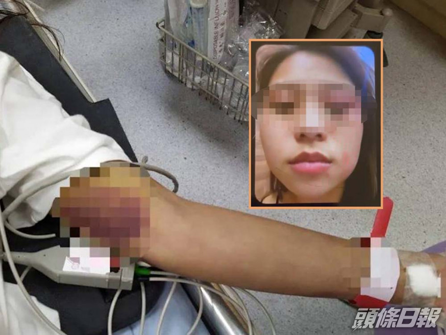 胡女生前曾向家人發送傷痕照。互聯網圖片