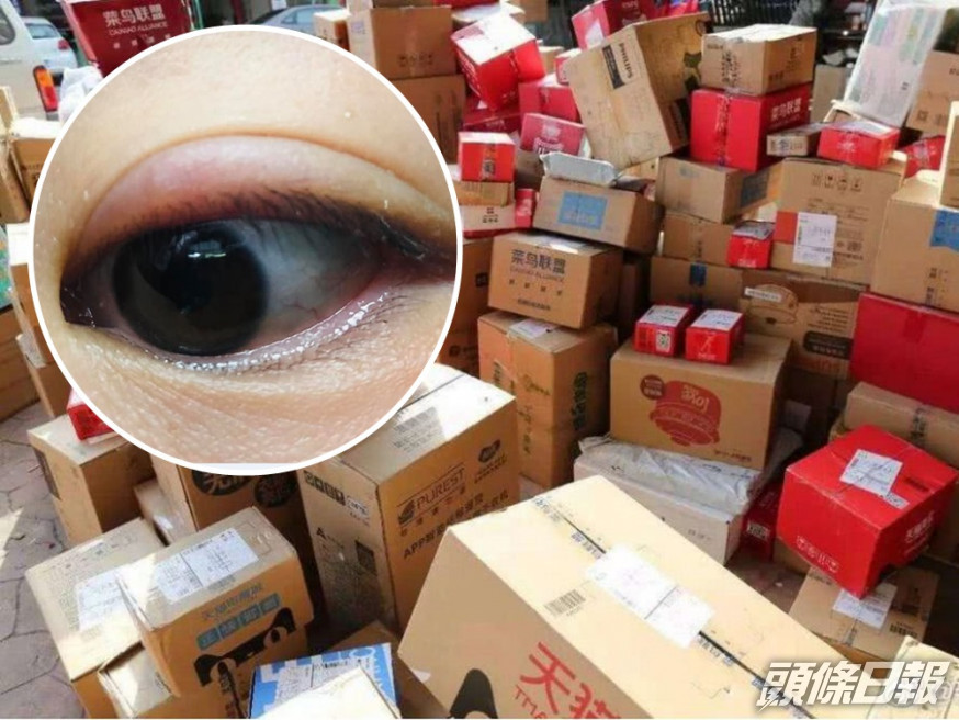 網民指收取包裹時捽了一下眼,即使眼紅腫多時。