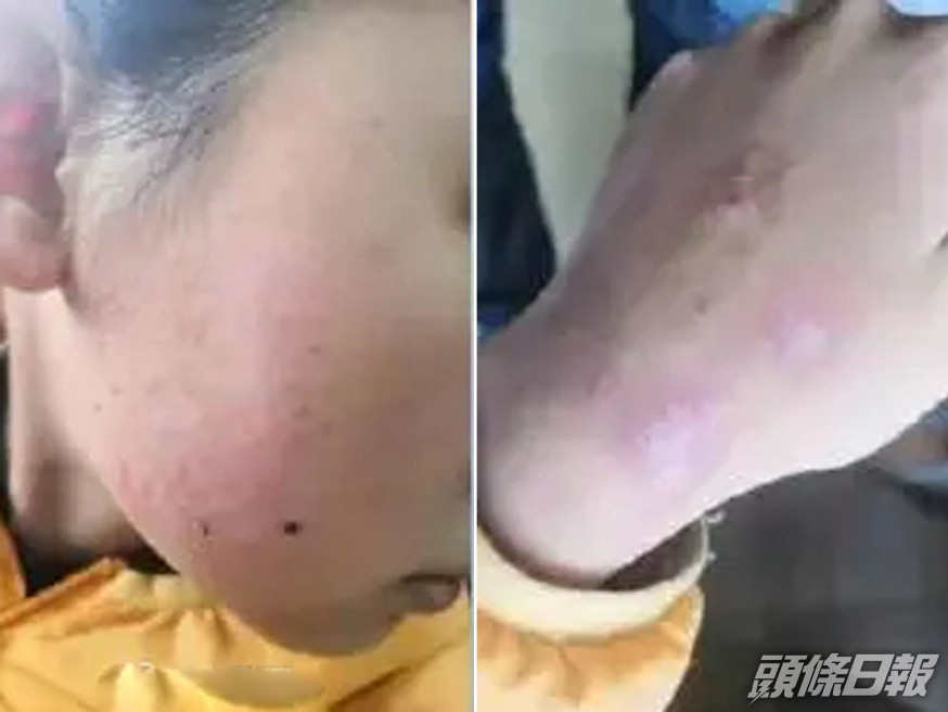 單親母暴力逼迫小學女兒掌握大學英語。